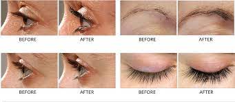 Apply rapidlash to the base of the upper eyelashes using the applicator brush. Rapidlash Resnic I Brovej Povyshaya Syvorotka 3 Ml 0 1 Zhidk Unc Primerno 2 96 Ml Novyj I Zapechatannyj Ebay