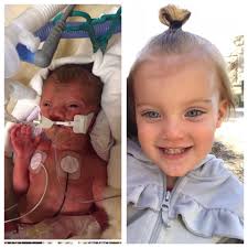 Every family hopes for a smooth start, but when the unexpected happens, our  Jennifer Leigh Muma NICU at the Muma Children's Hospital at TGH is here  with advanced neonatal care and a