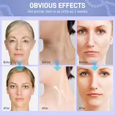 Amazon.com: Hotiary Advanced Neck Firming Cream, Tighten & Lift Moisturizer  for Face Neck Chest, Anti-aging Neck Creams for Sagging, Christmas ...