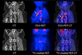 What Is The Difference Between An X Ray A Ct Scan And An Mri