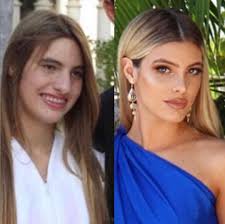 Eleonora pons lele maronese (born: Plastic Surgeon Dr Kassir On Instagram Our Patients Love To Show Off Lelepons Designer Rhinoplasty Body Modification Prominente Plastische Chirurgie Body