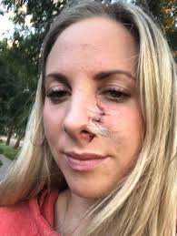 Sun Burst for July 16, 2020