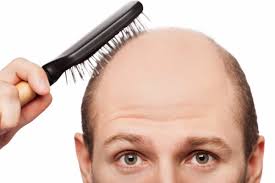 Cinco Elementos Clave Para Evitar La Perdida De Cabello