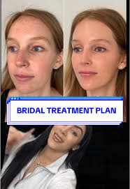 Replying to @Rivas IMO THE FERN is the best treatment to soften laugh...