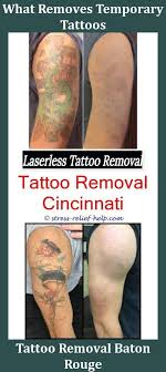 It requires various sittings and also has minimal risk of scarring. Pico Laser Tattoo Removal Aftercare Tattoo Design