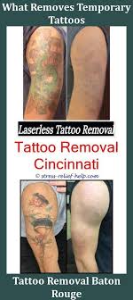 Find out the best steps to avoid infection and complications. Pico Laser Tattoo Removal Aftercare Tattoo Design