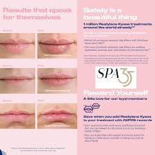 You would also get a slight plump and smoother feeling. Lip Injections In Boise Dermal Lip Fillers Spa 35