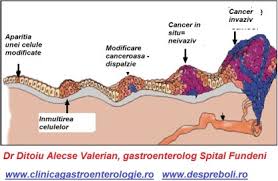 Anemia 3 cancerul analize sange, human papillomavirus hpv infection treatment hpv warts on mouth. Cancerul De Pancreas Evolutie Complicatii Tratament Supravietuire Clinica Gastroenterologie Bucuresti 0758 751 841