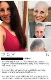 That's where headcovers comes in. A Cancer Patients Testimonial For Monat Antimlm