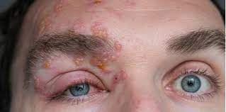 Through this post i'm going to line up 30 of the best new funny jokes in english and some of them. Apa Itu Kayap Ini Penerangan Ringkas Berkenaan Dengan Penyakit Ini