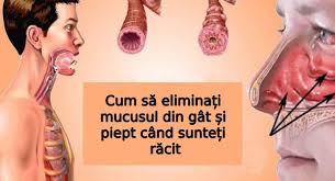 Se bea fierbinte și se inhalează aburul. Cum SÄ EliminaÈi Mucusul Din Gat Èi Piept Cand SunteÈi RÄcit Wawlist