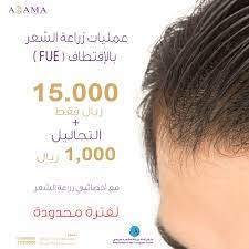 مستشفى أدمة on twitter عمليات زراعة الشعر بالإقتطاف fue الأخصائية د عفراء محمد و الأخصائية د سماح بن ضياء لفترة محدودة 12500 ريال شامل التحاليل الأفضلية للحجز المسبق الرياض فقط 0114660000 زراعة الشعر