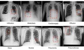 Twitter Radiologicworld Foamrad Foamed Radiology Imaging Radiologist Radiographer Radtech X In 2020 Radiology Imaging Medical Anatomy Medical School Studying