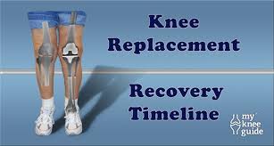 Road To Recovery Following Knee Replacement Knee Replacement Surgery Knee Replacement Exercises Knee Replacement