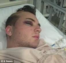 Australian tourist returns home after Bali motorbike crash