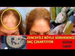 Saccikartantarif 100 Ise Yariyor Zencefili Saciniza Bu Sekilde Surun En Hizli Sac Uzatan Tarif Youtube Hizli Sac Uzama Sac Cilt Urunleri