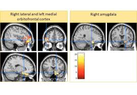 Maternal religiosity in relation to harsh parenting and child. Does Harsh Parenting Lead To Smaller Brains Udemnouvelles