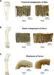 Model of the leg of achilles textured and ready for 3d printing. Excessive Salt Consumption Causes Systemic Calcium Mishandling And Worsens Microarchitecture And Strength Of Long Bones In Rats Scientific Reports