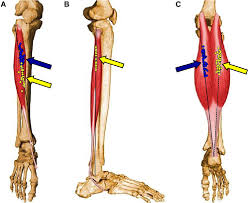 Figure 3 From Atlas Of The Muscle Motor Points For The Lower