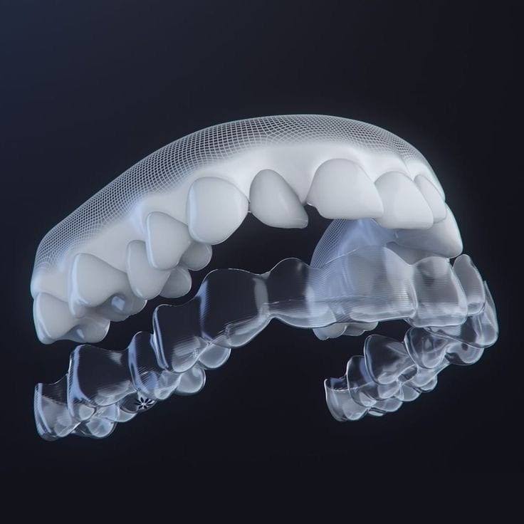 Invisalign Moderate Package product image