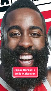 James Harden's Smile Transformation Journey