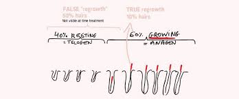 does hair regrow after electrolysis