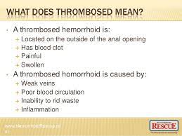 There are several treatments that use heat to destroy. Thrombosed Hemorrhoid Treatment