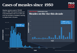 How Bad Is The Measles Comeback Heres 70 Years Of Data