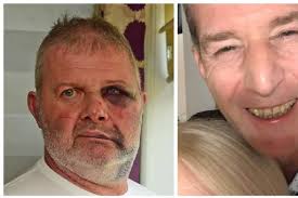 Thug who battered stroke victim in brutal street attack avoids jail