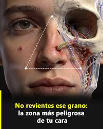 Cuando te sale un "Ojo de Pescado" no es un callo común, este crea raíces y  te... Ver Más...