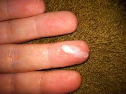 This is especially common when a woman is in her third. Watery Discharge After Ovulation Am I Pregnant