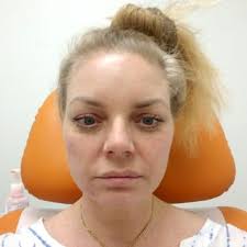 AVA KHOSRAVIANI, MD, FAAD