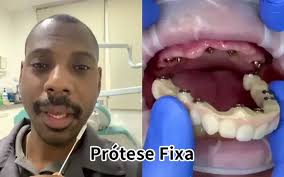 amil dental 205 cobre prótese