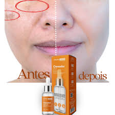 Sérum Clareador de Melasma Dermachem Com Ácido Mandélico Niacinamida  Clareia Manchas 30 Ml | Shopee Brasil