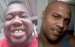 Death Of Alton Sterling's Cousin A 'Homicide': Coroner