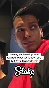 Makeup Artist Covers Black Eye with Foundation