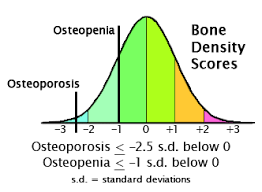 pin on yoga for osteoporosis build bone mass with yoga