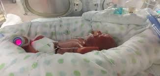 It can be dangerous for twin and triplet pregnancies to carry on after the planned birth dates. Premature New Zealand Twins Born At 23 Weeks Otago Daily Times Online News