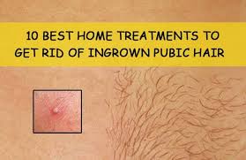 Ingrown hairs commonly develop in areas. 10 Effective Home Remedies To Get Rid Of Ingrown Pubic Hair Soon