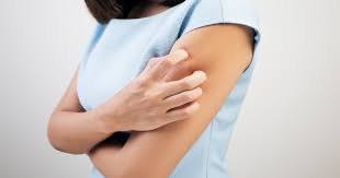 Gürtelrose gürtelrose ist eine folgeerkrankung der windpocken, die meist im höheren alter auftritt. Gurtelrose Symptome Ansteckung Behandlung Ratgeber Nerven