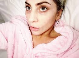 Das foto kommt bei ihren fans gut an. Lady Gaga Age Ungeschminkt Lady Gaga Ungeschminkt