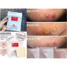They'll cost you only $10, down from $15. Cosrx Pimple Patch It Daiso Beauty White And Collagen Facebook