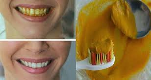 Oui Le Curcuma Fait Blanchir Les Dents Des Fumeurs Et Des Buveurs De Cafe Voici Comment L Utiliser Blanchir Les Dents Blanchir Les Dents Naturellement Sante Beaute