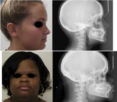 Who has the most beautiful women in the world?