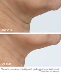 Skin Care Tips For Beautiful Skin Neck Cream Strivectin Improve Skin Elasticity