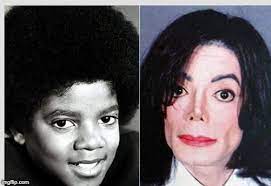 Dubbed the king of pop. So Hat Sich Michael Jacksons Gesicht Uber Die Jahre Verandert