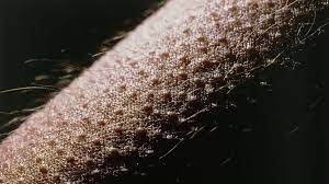 People interested in goosebumps skin also searched for. Why Do You Get Goosebumps Bbc Future