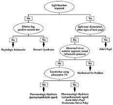 Flow Chart For Sorting Out Anisocoria Direct Light