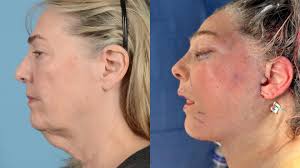 Dr. Henry A. Mentz III