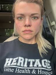 I still need a few Lipo-dissolve models for the following areas: •Chin ✓  •Lower abdomen ✓ •Upper abdomen •Bra bulge •Love handles •Thighs ✓ Deposit  required• October dates available 😍